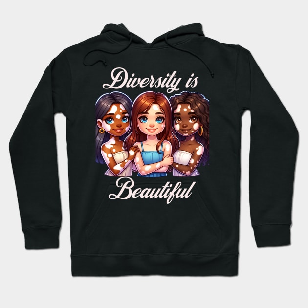 Vitiligo Awareness and Acceptance Diversity is Beautiful Hoodie by Mind Your Tee